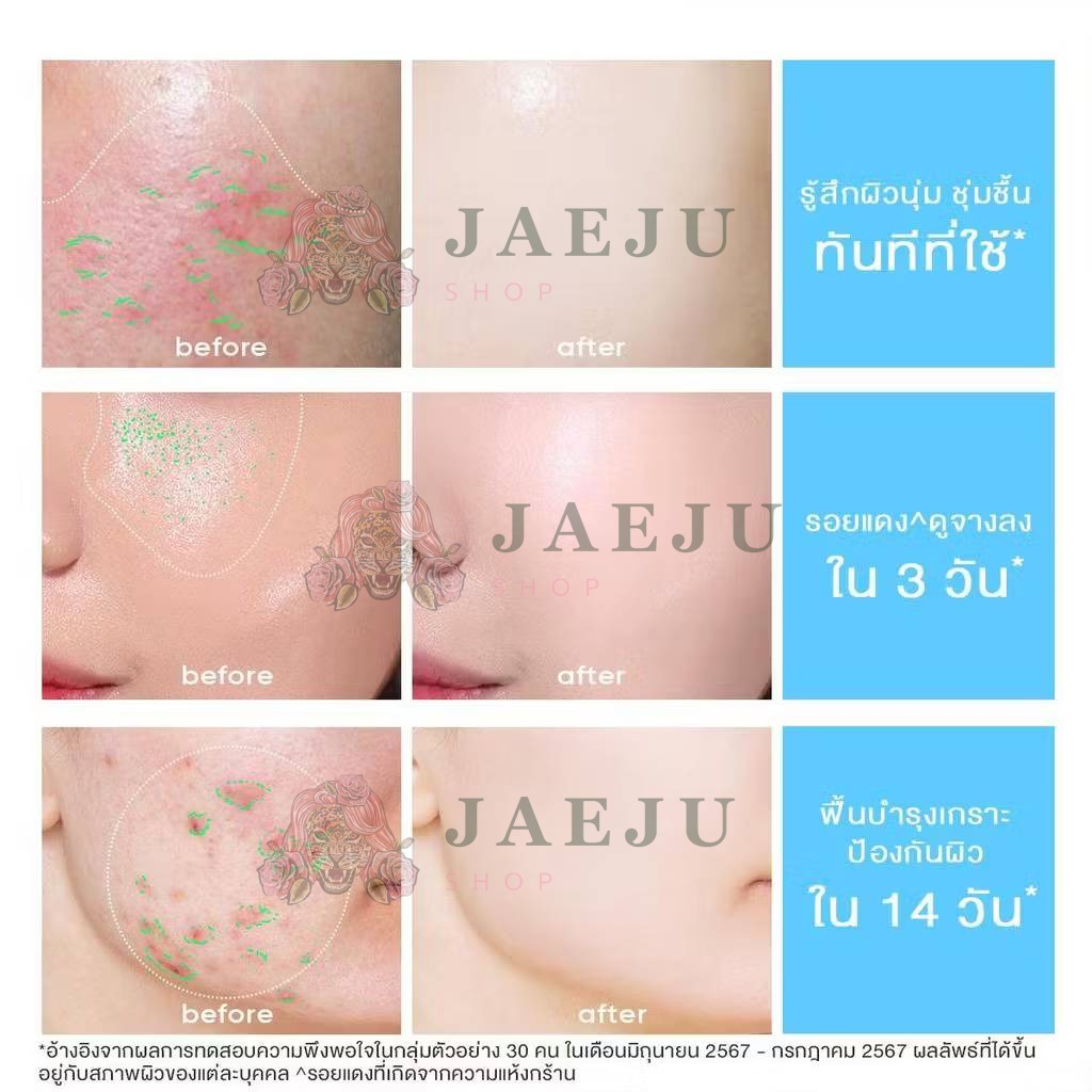 Skintific 5X creamide barrier moisture gel สกินทิฟฟิค 5เอ็กซ์มอยส์เจลสบายผิว 7g - Image 6