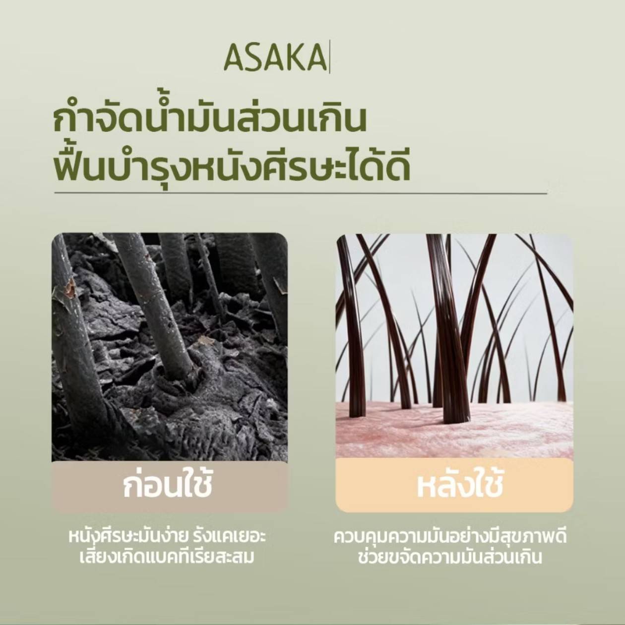 ASAKA chamaecyparis obtusa amino acid shampoo อาซากะ แชมพูขจัดรังแค 500g - Image 11