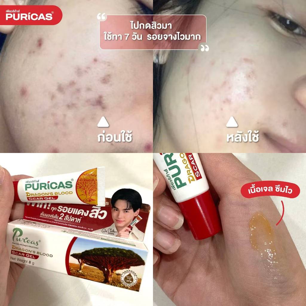 Puricas dragon's blood scar gel เพียวริก้าส์ ดราก้อน สการ์เจล 20g - Image 8